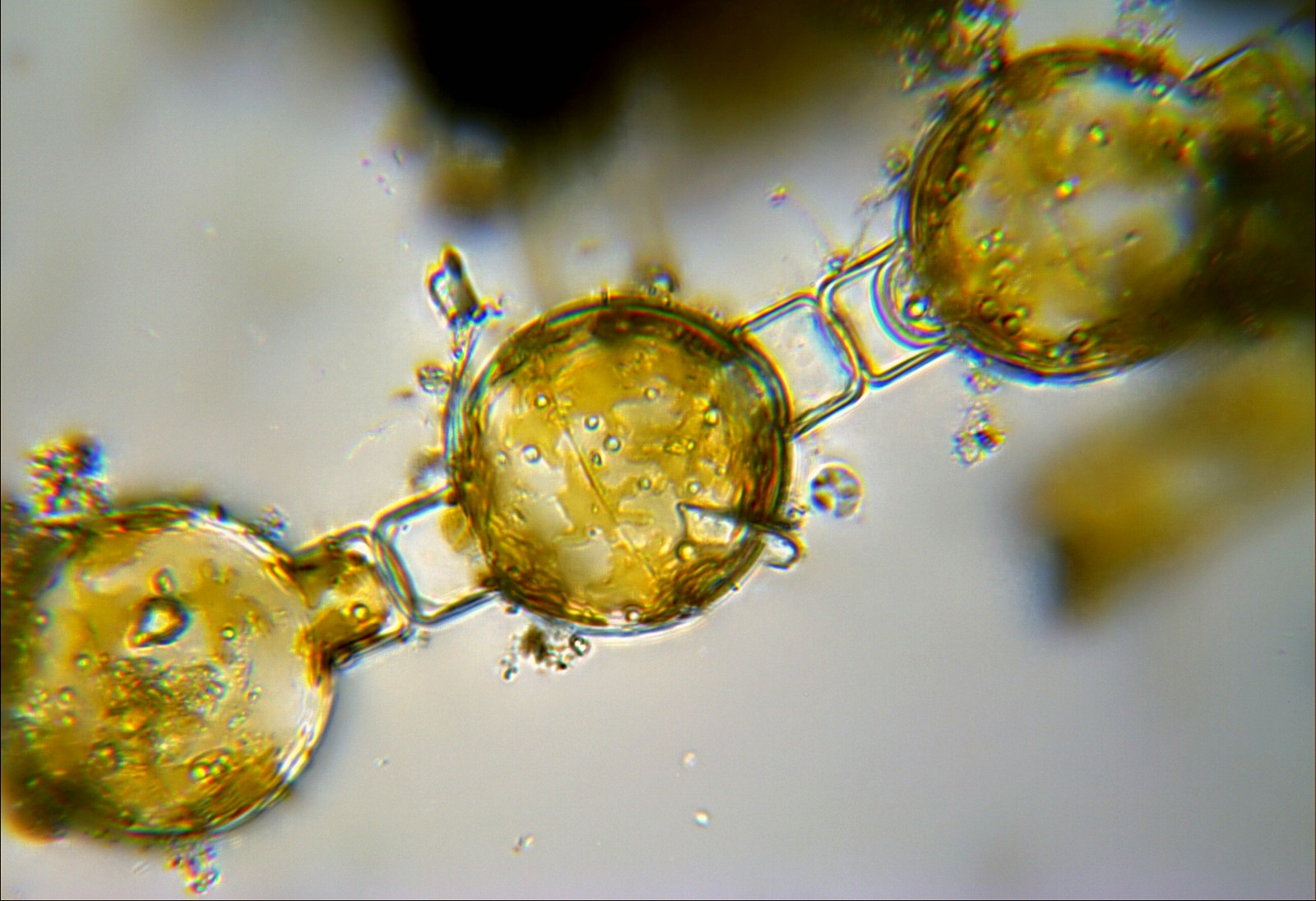 Melosiria varians auxospore